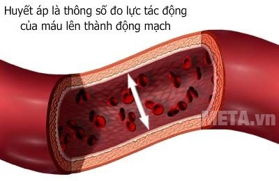 Bệnh huyết áp cũng gây nên những biến chứng nguy hiểm 