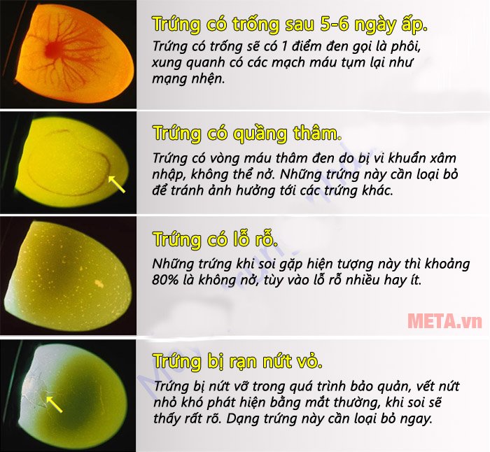 Các dấu hiệu của trứng khi soi 