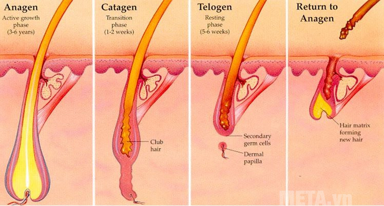 Triệt lông IPL