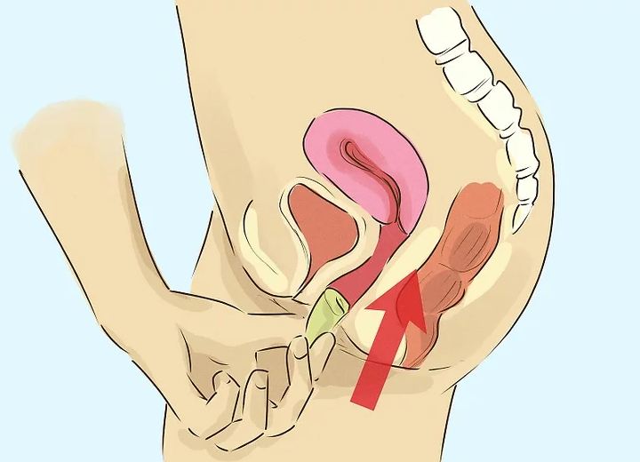 Cách đặt cốc nguyệt san vào vùng kín