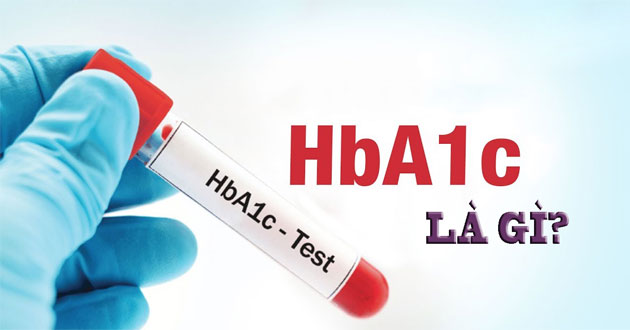 HbA1c là chỉ số gì trong bệnh đái tháo đường?
