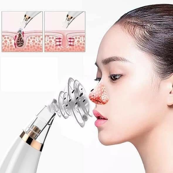 máy hút mụn có tốt không