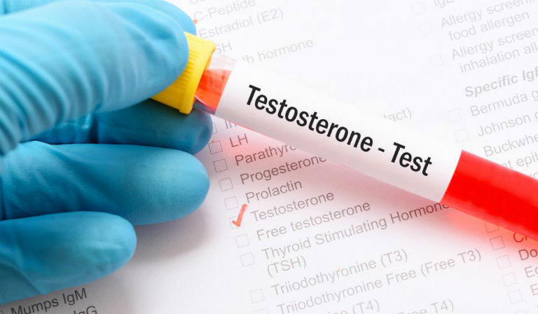 Rối loạn sản xuất Testosterone
