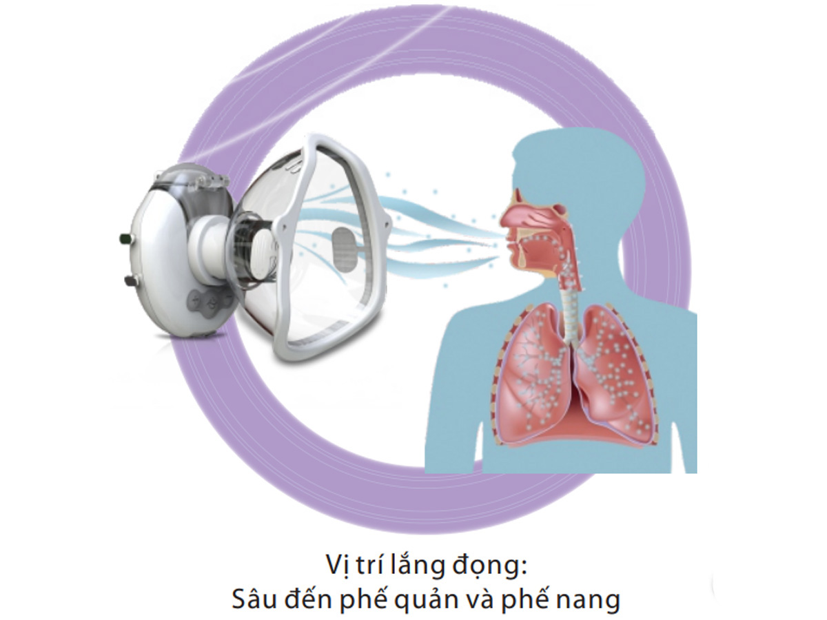Máy khí dung siêu âm
