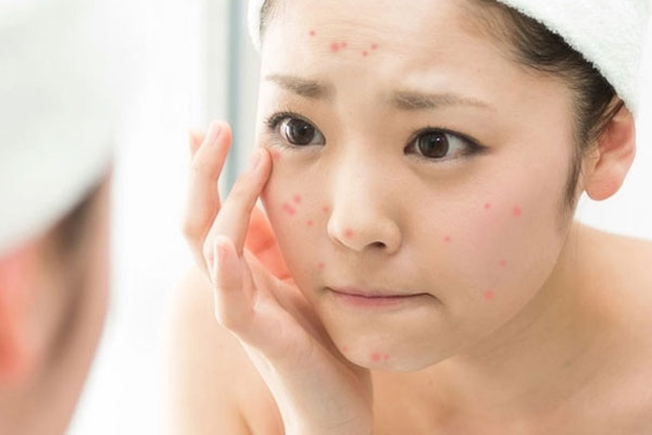Tác hại của nước cứng với làn da