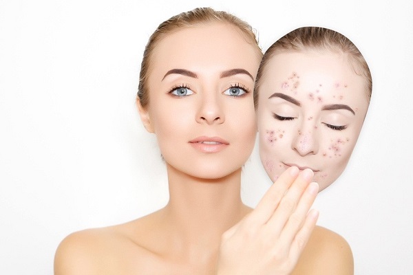 Tinh dầu quế giúp dưỡng da, trị mụn