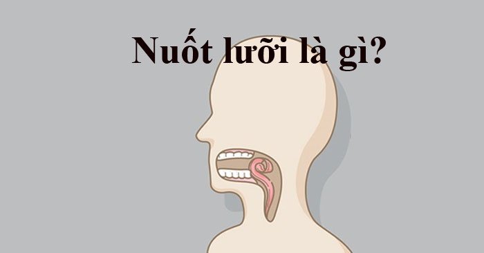 Nuốt lưỡi trong bóng đá có nguy hiểm không?