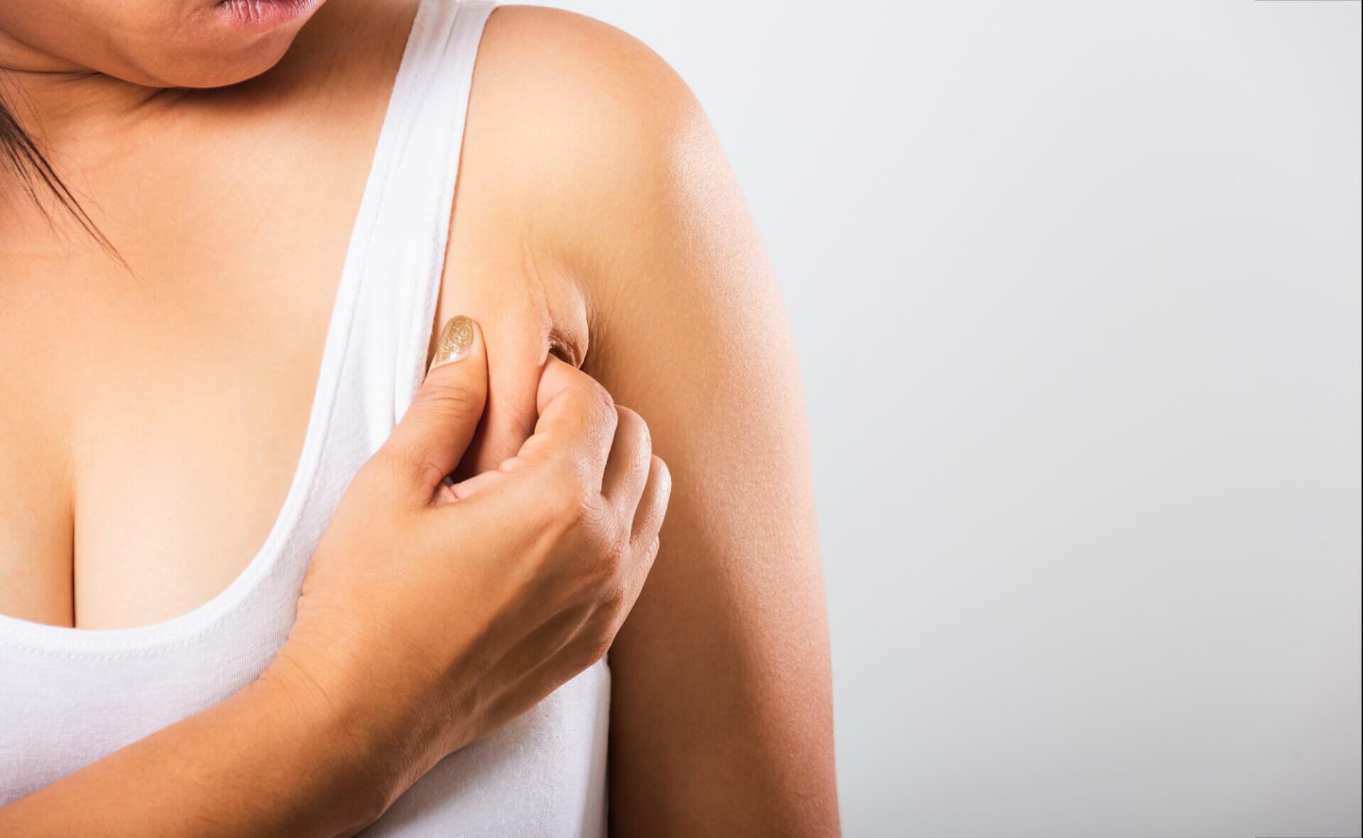 Mỡ Nách Nhiều Do Đâu? 5 Cách Giảm Mỡ Nách Hiệu Quả Tại Nhà Dễ Thực Hiện