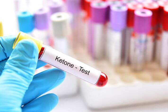 Thường xuyên kiểm tra Ketone giúp điều chỉnh kịp thời