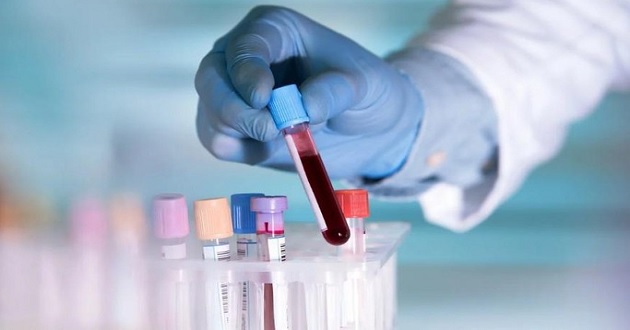 Tại sao truyền máu phải phù hợp về nhóm máu? 
