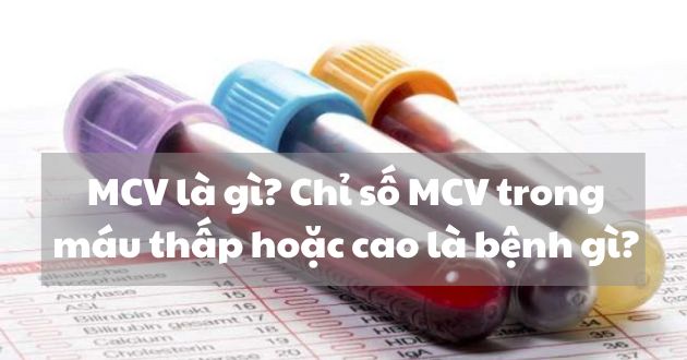 Làm thế nào để tăng hoặc giảm chỉ số MCV trong máu?
