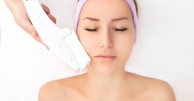 Công nghệ IPL là gì?