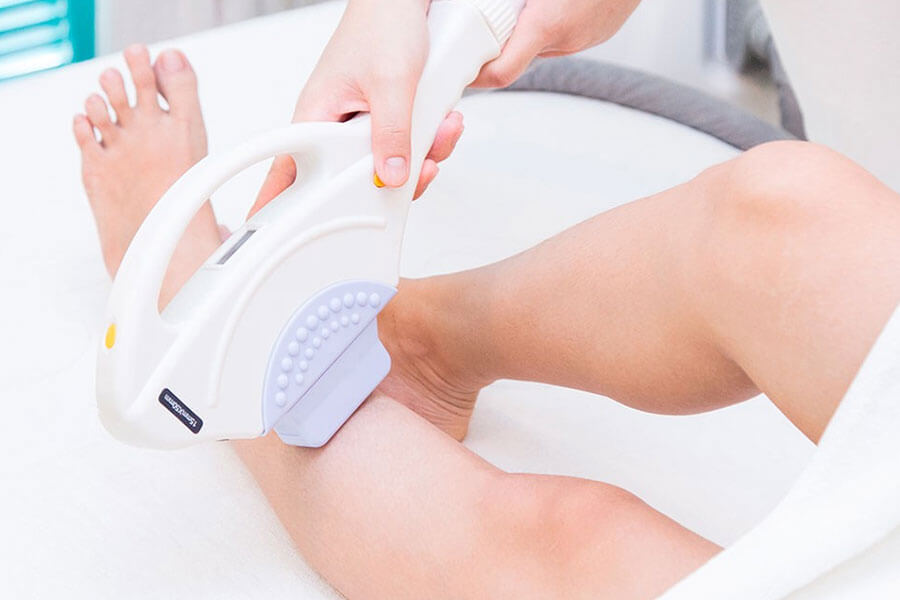 Quy trình điều trị bằng IPL