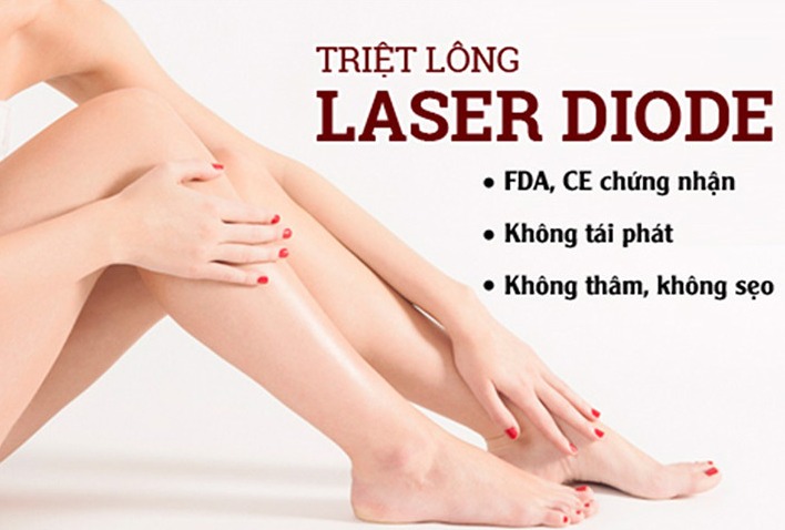 Công nghệ triệt lông Laser Diode