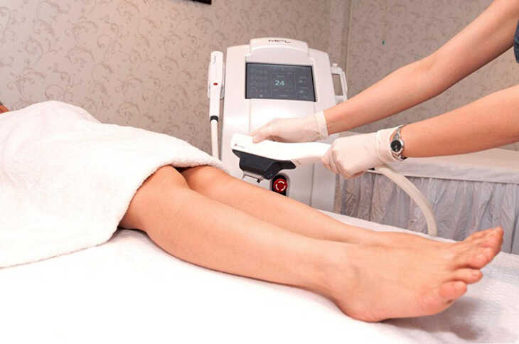 Quy trình triệt lông bằng công nghệ AFT