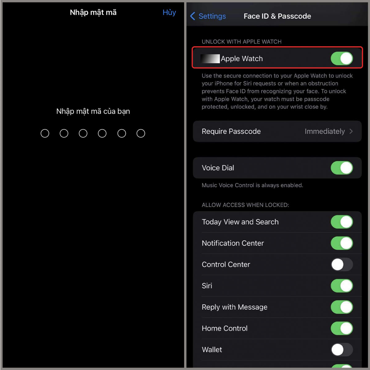 Kéo xuống tìm phần watchOS trên Apple Watch (Mở khóa bằng Apple Watch) → Kích hoạt Apple Watch sang vị trí bật (màu xanh)