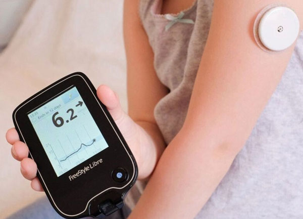 Máy theo dõi đường huyết liên tục CGM có giá bao nhiêu?