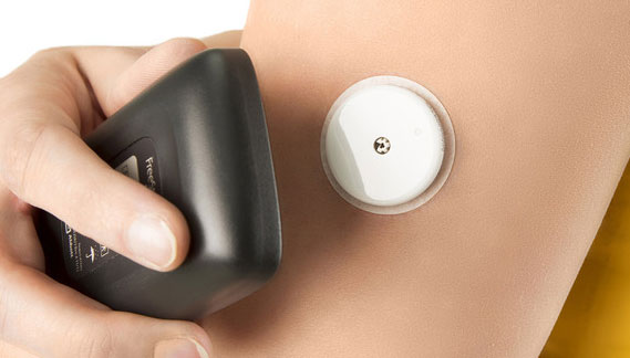 Những hạn chế của máy đo đường huyết liên tục