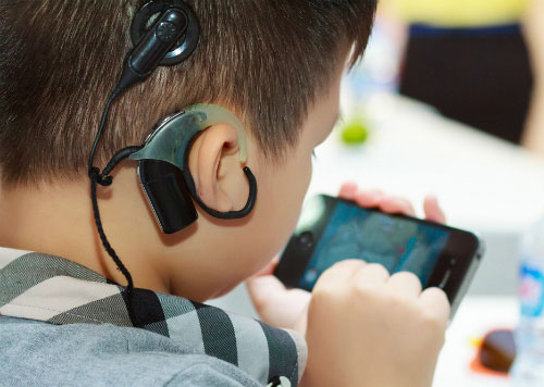 Ốc tai điện tử Cochlear