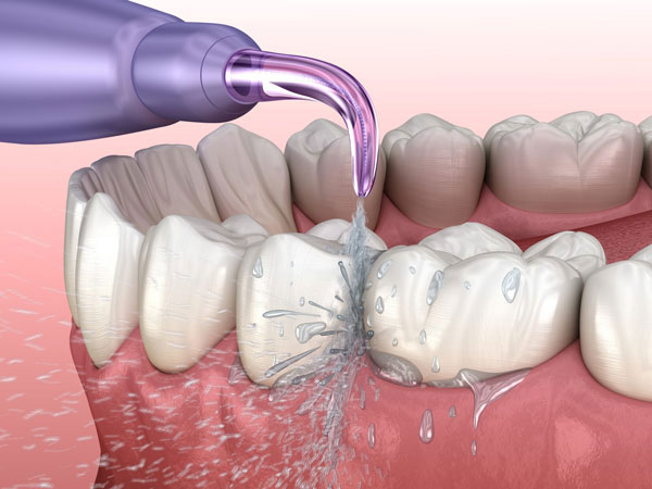 Nguyên lý hoạt động của máy tăm nước