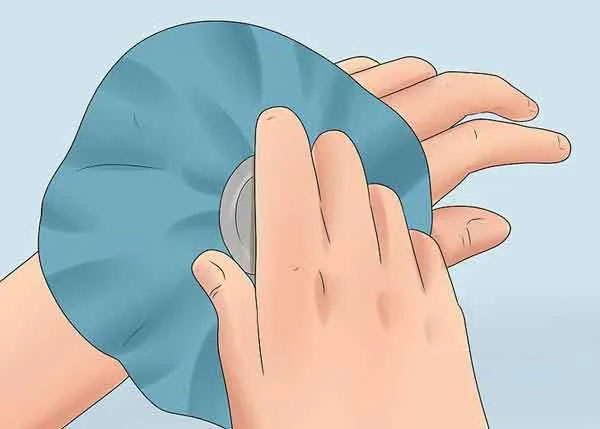 Nổi mề đay chườm nóng hay lạnh?