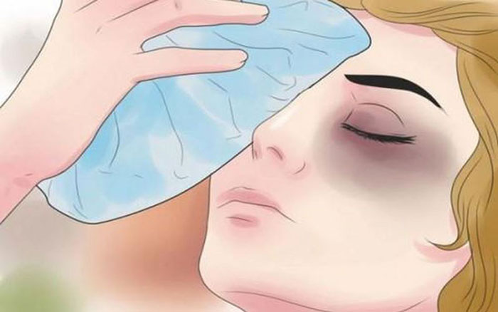 chườm khăn lạnh để giảm đau rát
