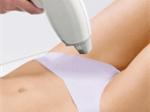 Top máy triệt lông vùng bikini tốt nhất hiện nay